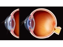 NMN may treat glaucoma