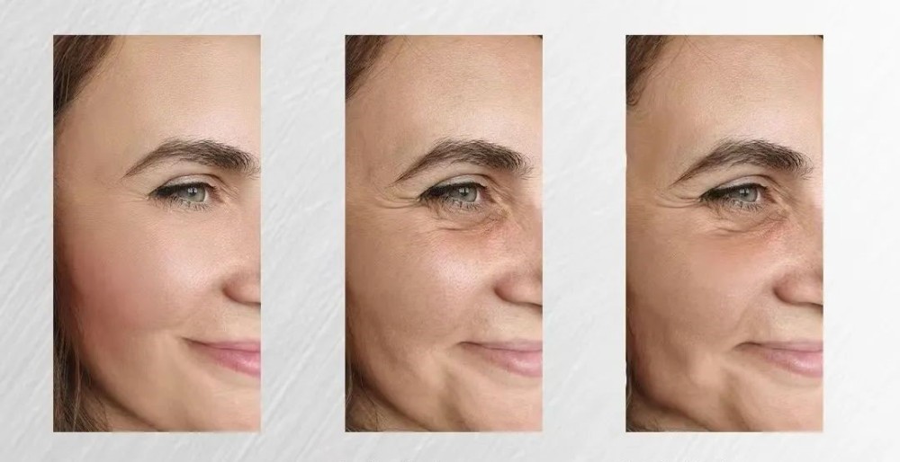 The age-stage state of aging