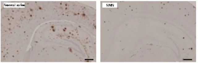 Figure 2. Microscopic images of amyloid plaques in mouse brains