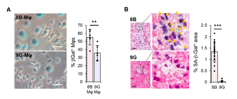 Immune cells and Cancer