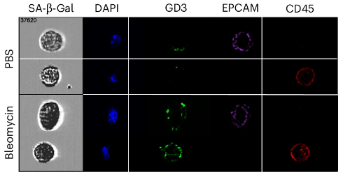New research uncovers the secret of immune escape in senescent cells